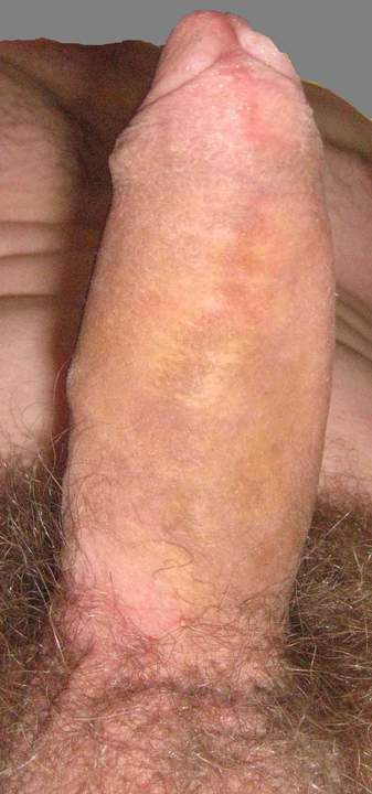 Adult image from iccockb4thee