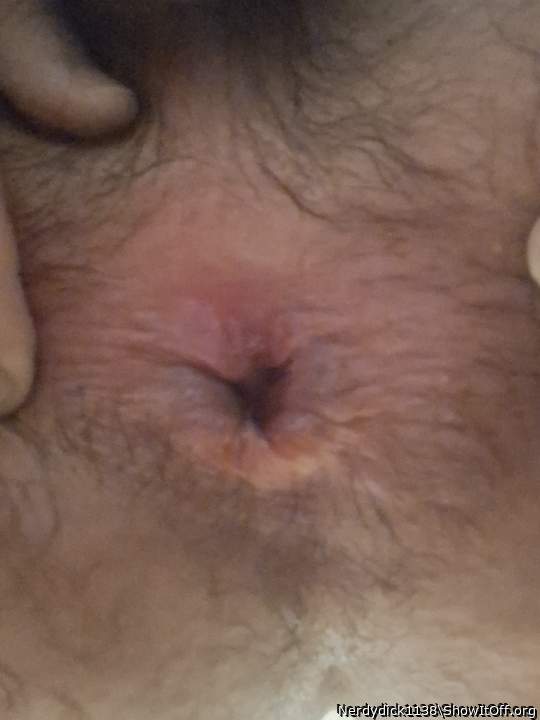 Freshly loosened anus