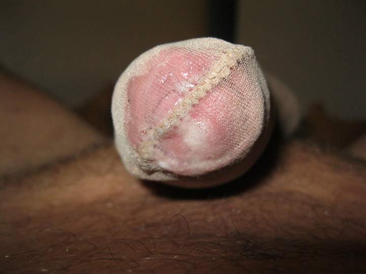 Adult image from marc66