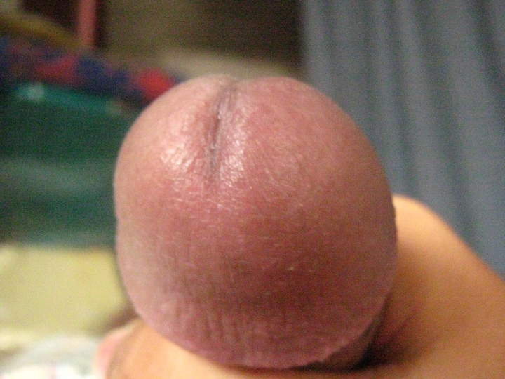 Adult image from bovine