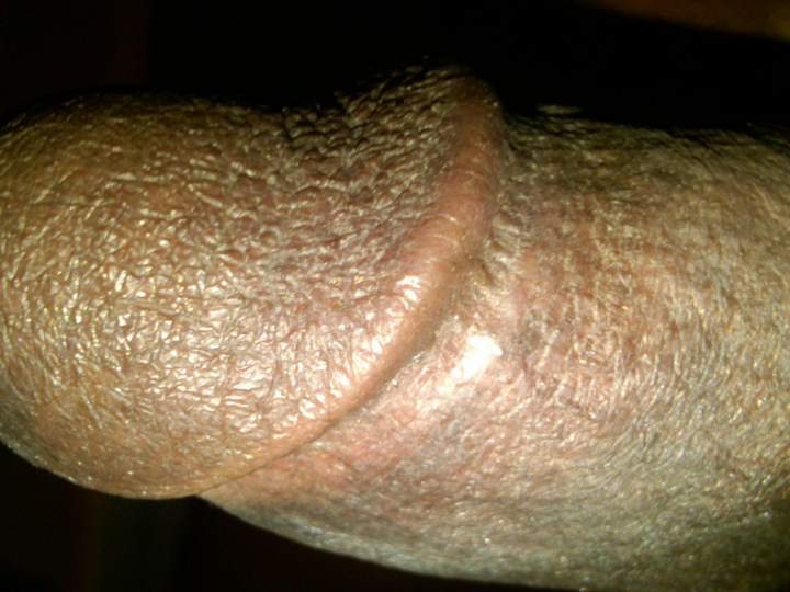 Adult image from GaryMPLS72