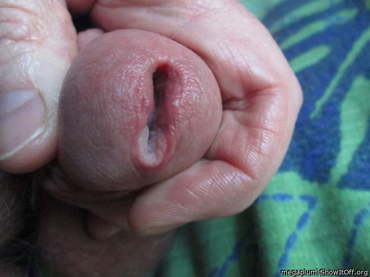 Gape after 16mm sound