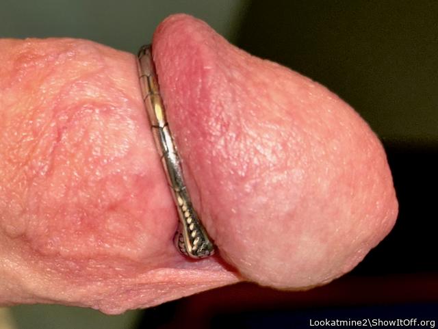Glans Ring Profile