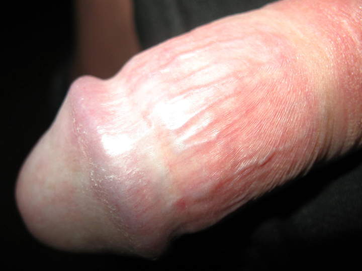Adult image from dickmann