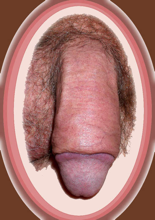 Adult image from slipper