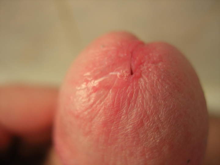 Adult image from winger70