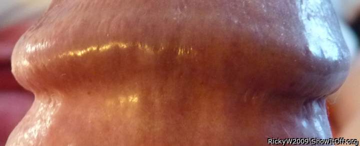 Corona and Sulcus