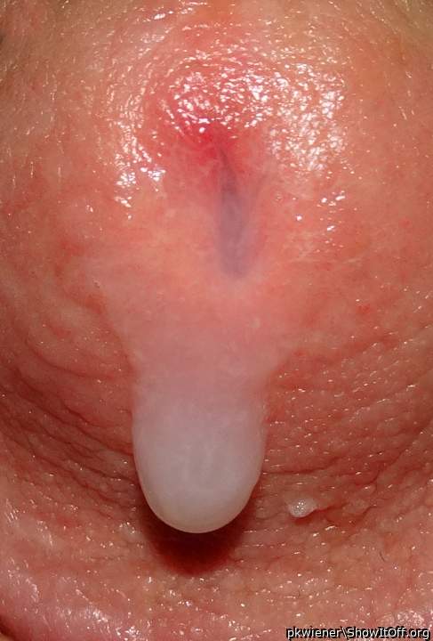 Adult image from pkwiener