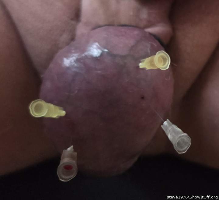 Needles in Balls