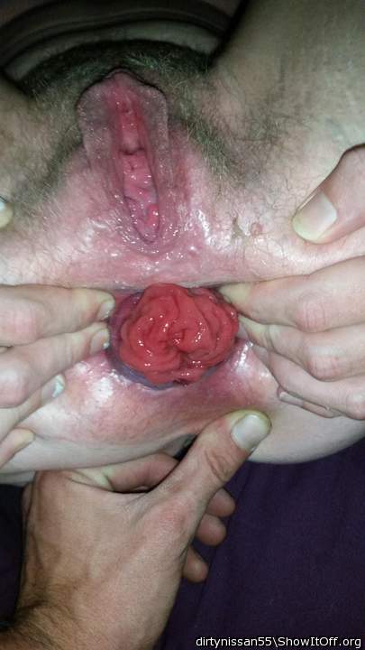 Hot wife prolapse