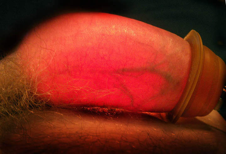 Adult image from slipper