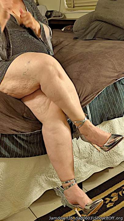 Legs