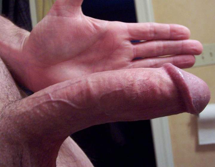 Adult image from Hanrahan17