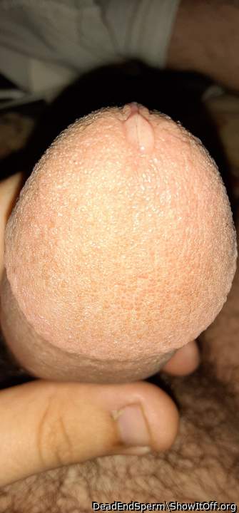 Adult image from DeadEndSperm