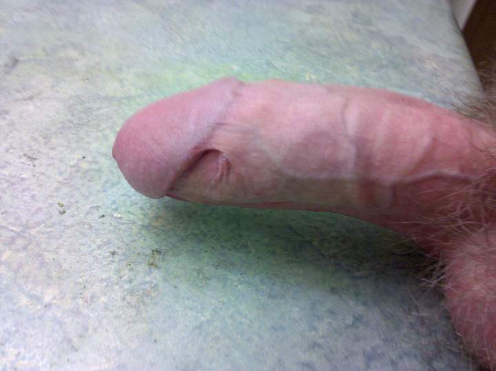 Great skin bridge pic! 