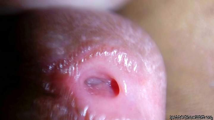 Peehole