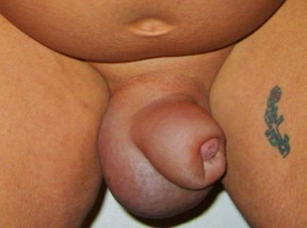 Injected