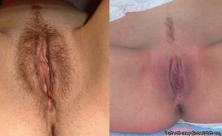 Hairy or Bald?
