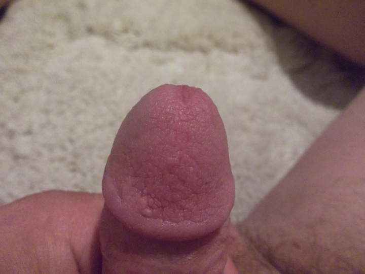 Adult image from PK75