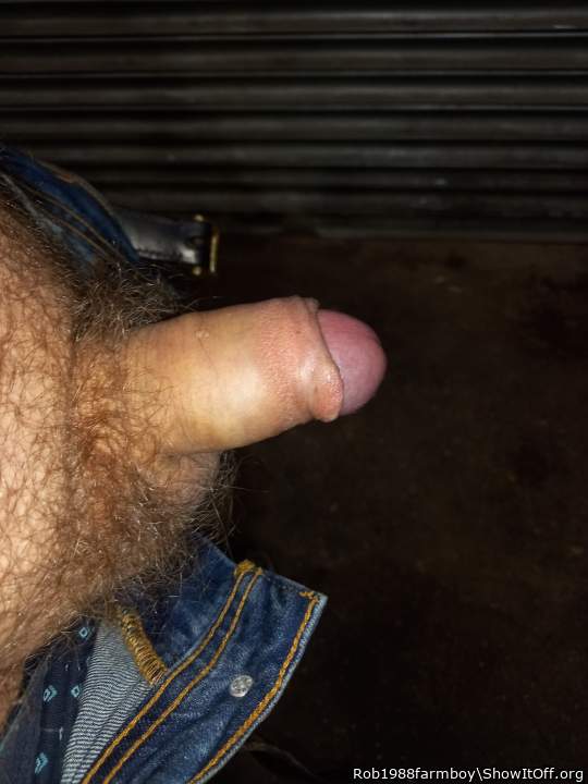 Swollen foreskin