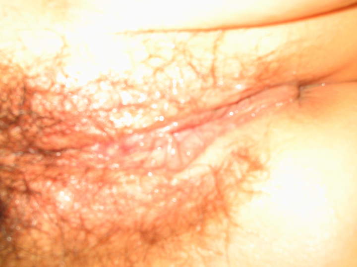 Adult image from ume