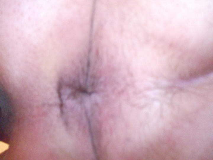 anal