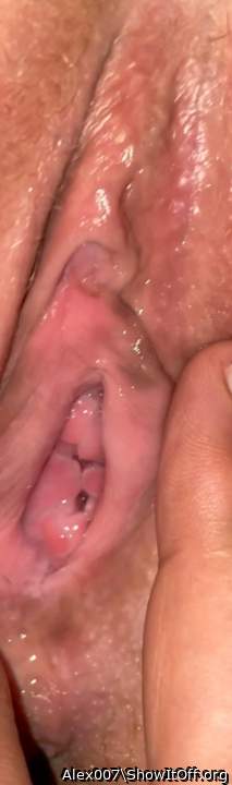 Vagina