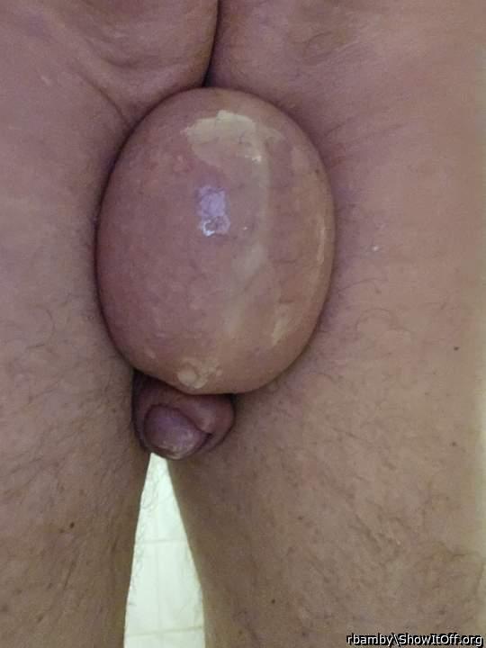 penis