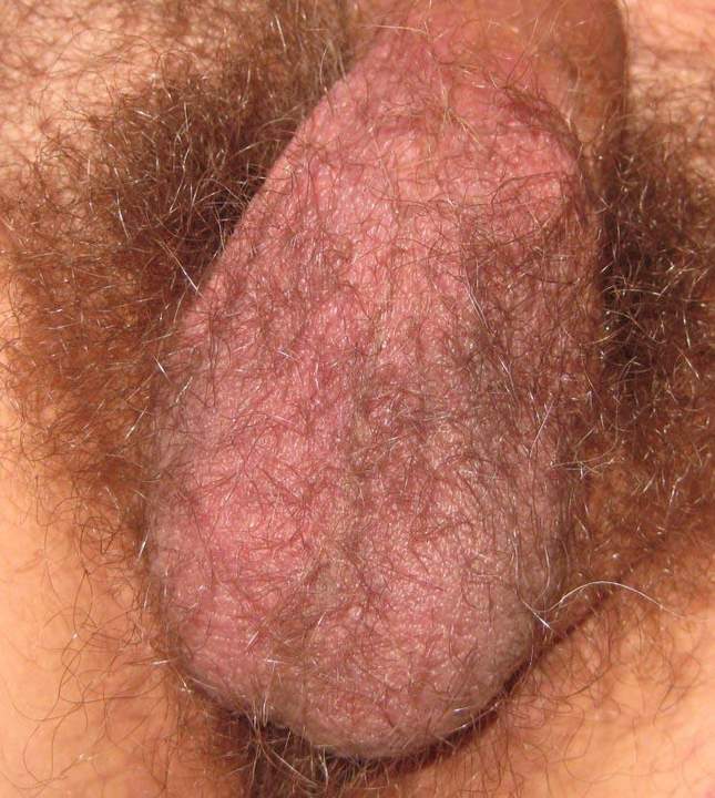 Adult image from iccockb4thee