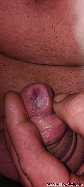 Extrem penis