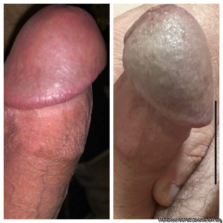 Adult image from Mattatuck06705