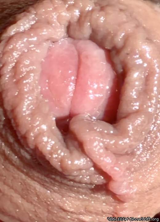 Foreskin Patterns