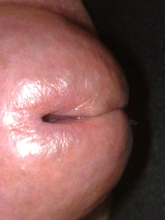 Adult image from padda