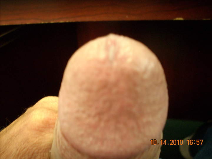 Adult image from wa2524