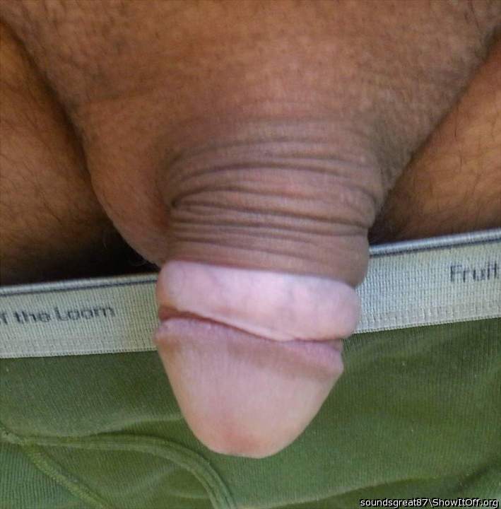 Steel glans ring holds my foreskin back