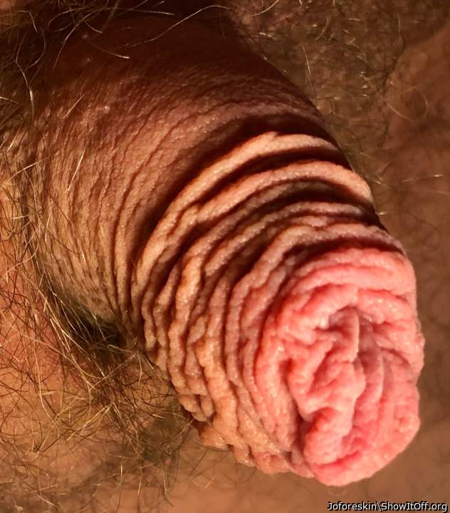 My foreskin when my cock is small� so you like it?
