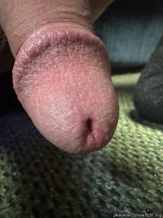 i love the structured skin of dickheads at circumcised cocks