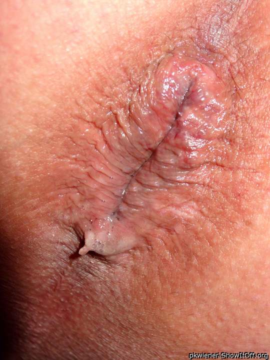Adult image from pkwiener