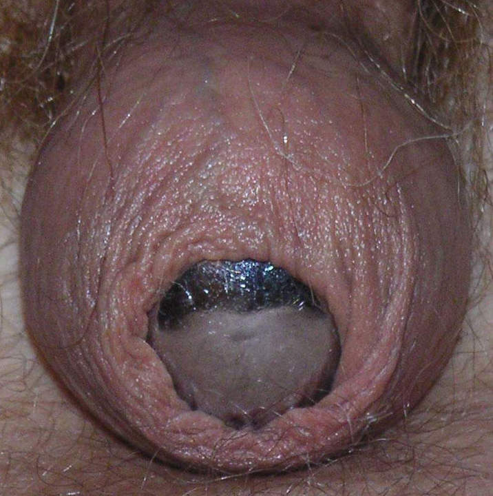 Adult image from slipper