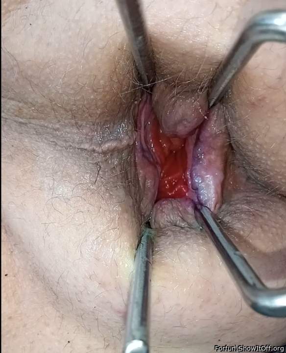 inspection
