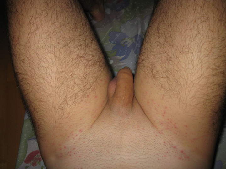 Adult image from Win_Gerhard