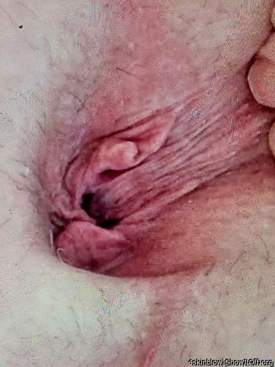 Butt hole