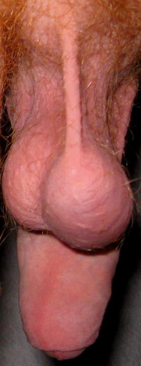 Richtige B�llchen  