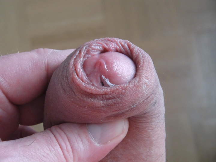 Adult image from smallfined