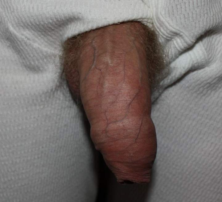 Adult image from Sharkie