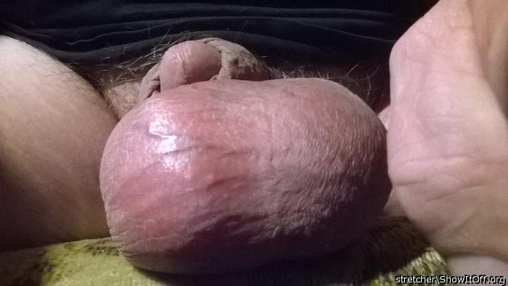 Adult image from stretcher