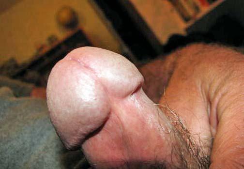 Adult image from turkeyneck