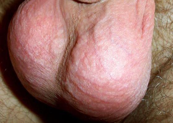 Adult image from lilsoftee