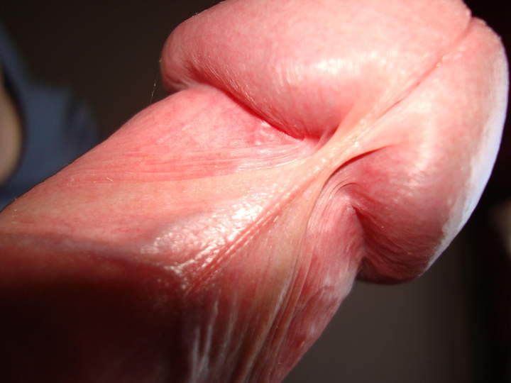 great shot. My frenulum snapped