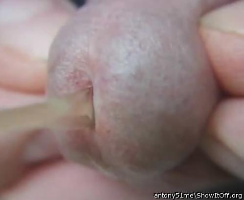 pee close up